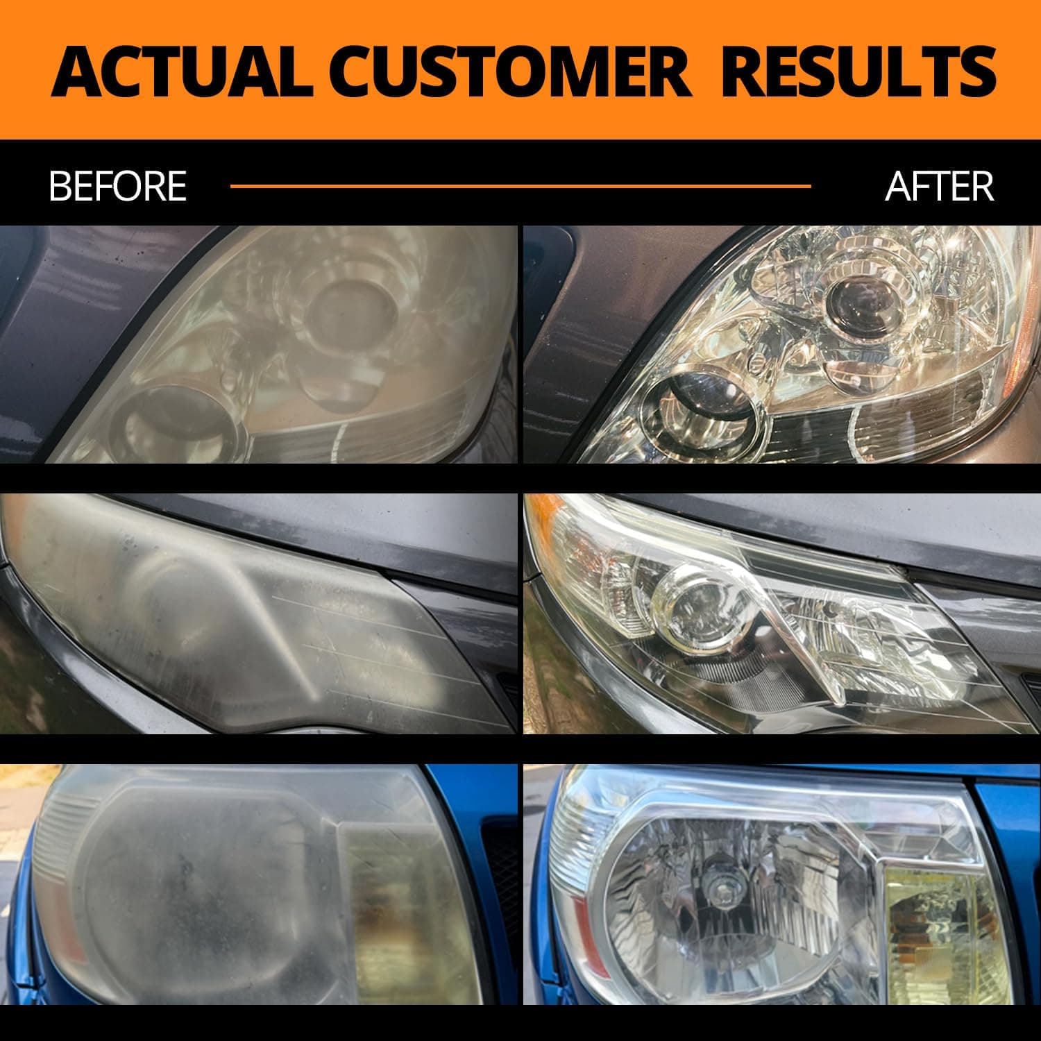 CERAKOTE® Ceramic Headlight Restoration Kit, No Power Tools, 10 Wipe Kit | Restores clouded, yellowed headlights, ceramic UV protection, 3-step wipe system, no power tools needed